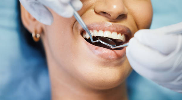 Best Emergency Dentist for Knocked-Out Tooth in New Providence, NJ